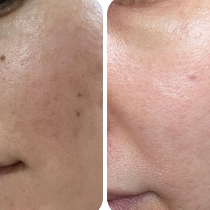 Сыворотка для Лица с Ретинолом CU SKIN Clean-Up Retinol Activator 0,5 %