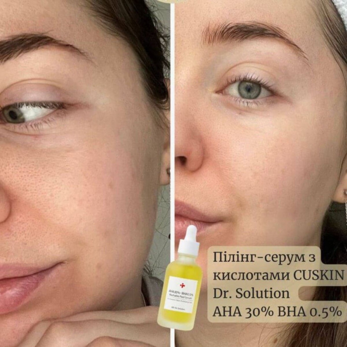Пилинг-Сыворотка с AHA и BHA кислотами CU SKIN Dr. Solution AHA 30 % BHA 0,5 % Washable Peel Serum