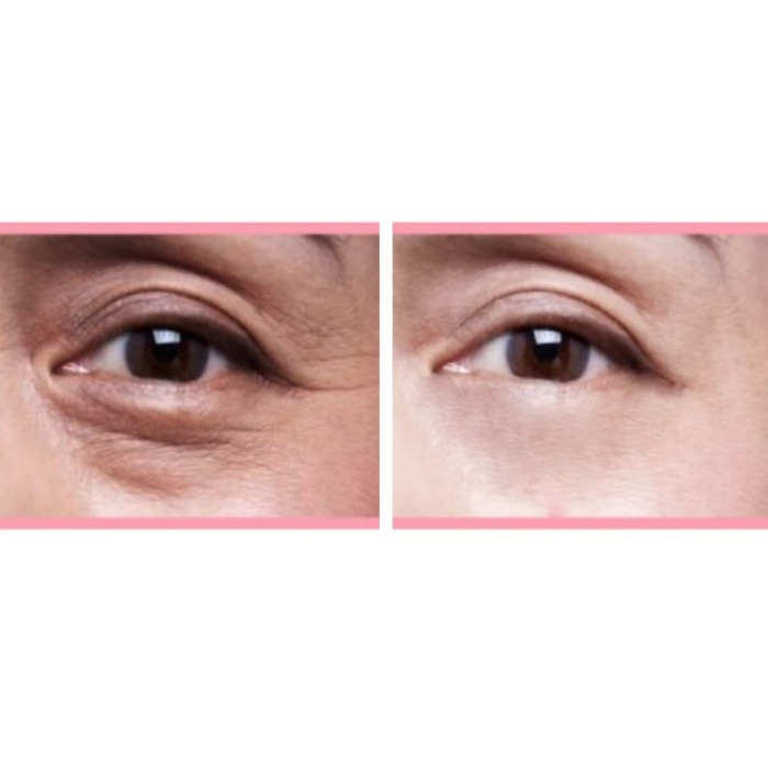 Капсульный Крем для Зоны Вокруг Глаз CU SKIN Dr. Solution Capsule Tone-Up Eye Cream