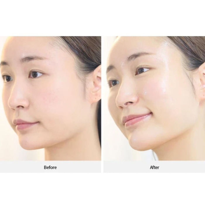 Омолаживающая Сыворотка для Лица с Двойным Эффектом REJURAN Healer Dual Effect Ampoule