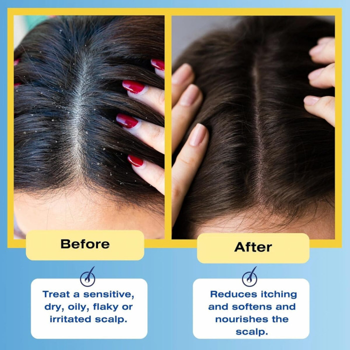 Успокаивающий Кондиционер для Волос и Кожи Головы Mediceuticals Therapeutic Scalp & Hair Treatment Rinse