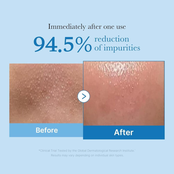 Гидрофильное Масло для Глубокого Очищения Пор Medicube Zero Pore Blackhead Deep Cleansing Oil
