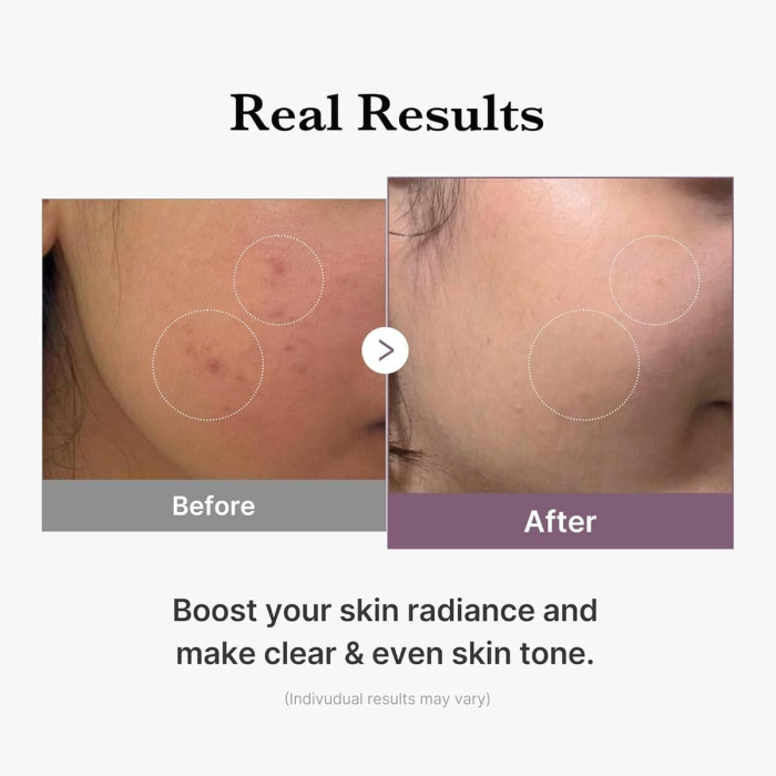 Тонер-Молочко с Глутатионом для Осветления и Сияния Кожи Medicube AGE-R Glutathione Glow Toner