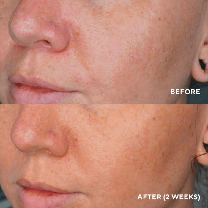 Сыворотка для Устранения Пигментации Кожи Разного Происхождения HydroPeptide LumaPro-C Skin Brightening Pigment Corrector