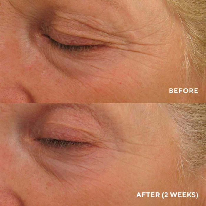 Лифтинг-Крем для Комплексного Омоложения Зоны Вокруг Глаз HydroPeptide Eye Authority