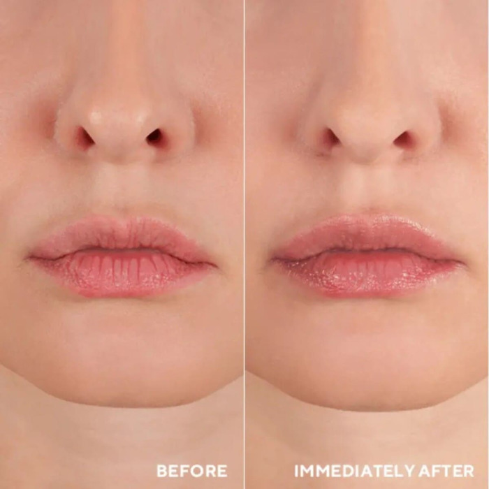 Гидрогелевые Маски-Патчи для Лифтинга Губ HydroPeptide PolyPeptide Collagel + Mask for Lip