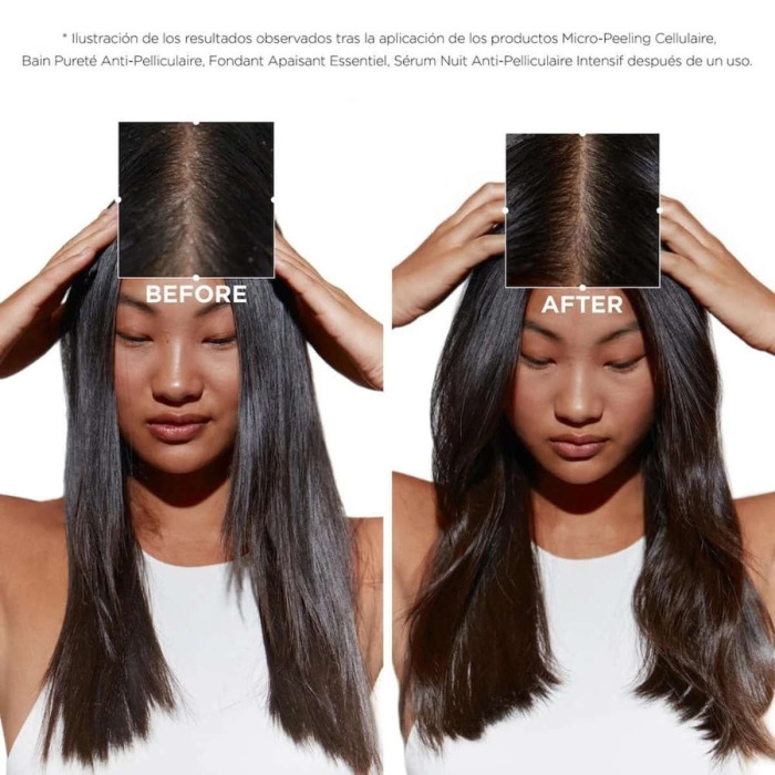 Маска для Поврежденных Волос, Склонных к Появлению Перхоти, Kerastase Symbiose Masque Revitalisant Essentiel