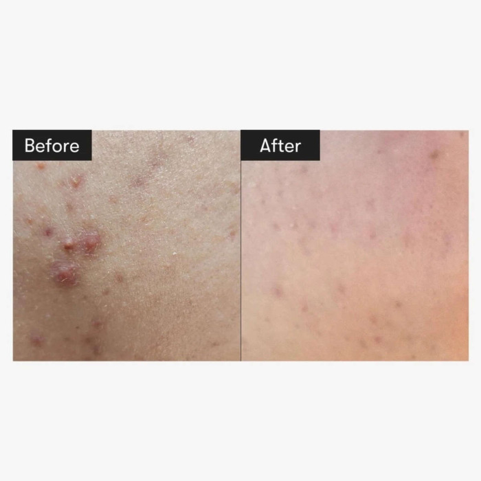 Сыворотка-Бустер со Спикулами VT Cosmetics Reedle Shot 100