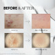Сыворотка-Бустер со Спикулами VT Cosmetics Reedle Shot 300